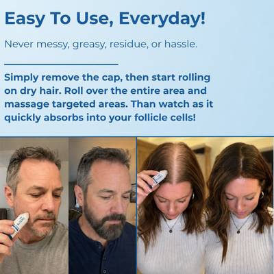 The RootRoller™ Full Hair Growth Complex