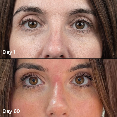 Liposomal Glutathione