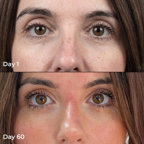 Liposomal Glutathione