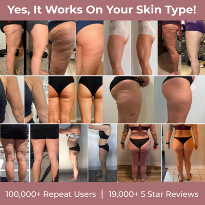 SmoothStem™ Micro-Collagen Complex