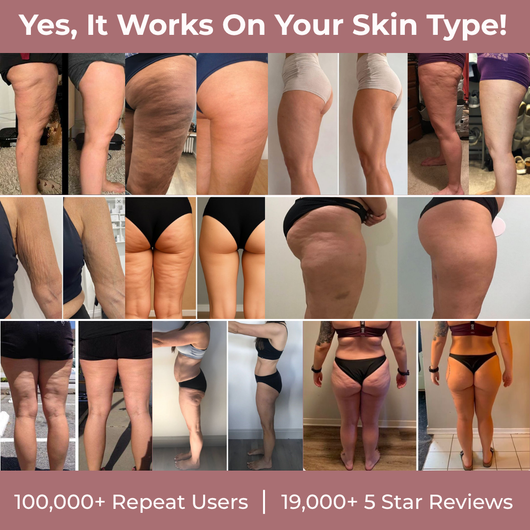 SmoothStem™ Micro-Collagen Complex